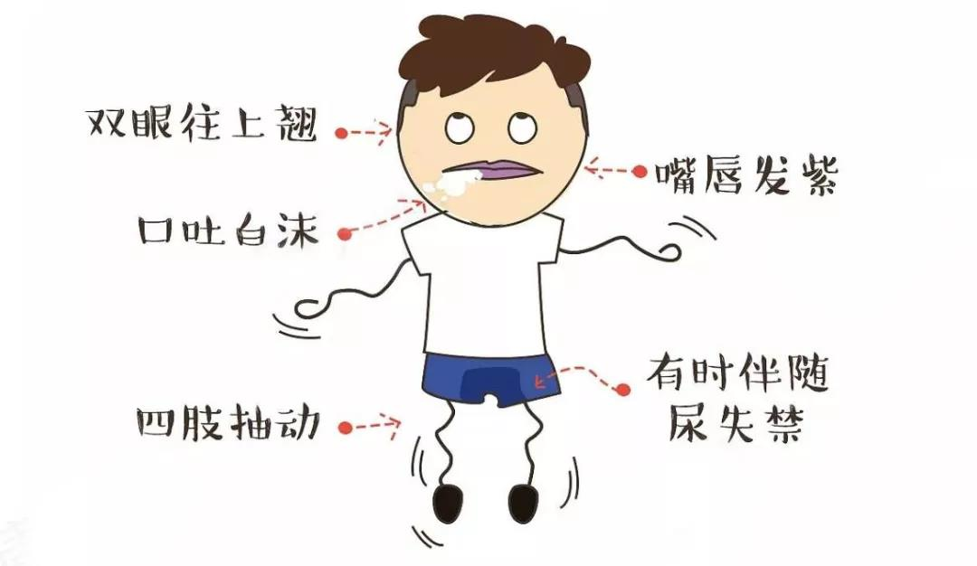 我叫“癫痫”，俗称“羊癫疯”，你了解我多少？